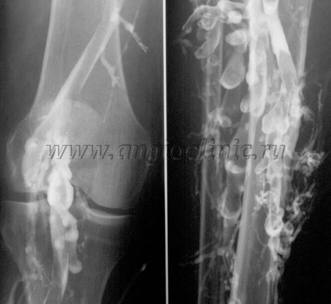 ულტრაბგერითი სკანირება